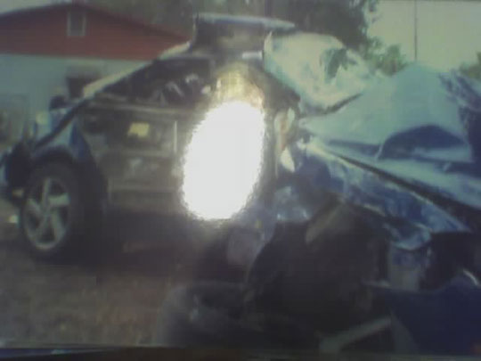Broken neck car accident