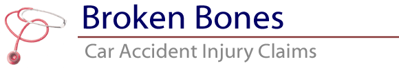 Broken Bone Car Accidents